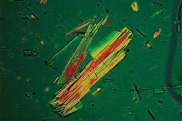 008-acetylsalicylic-acid-crystals-under-a-microscope.jpg