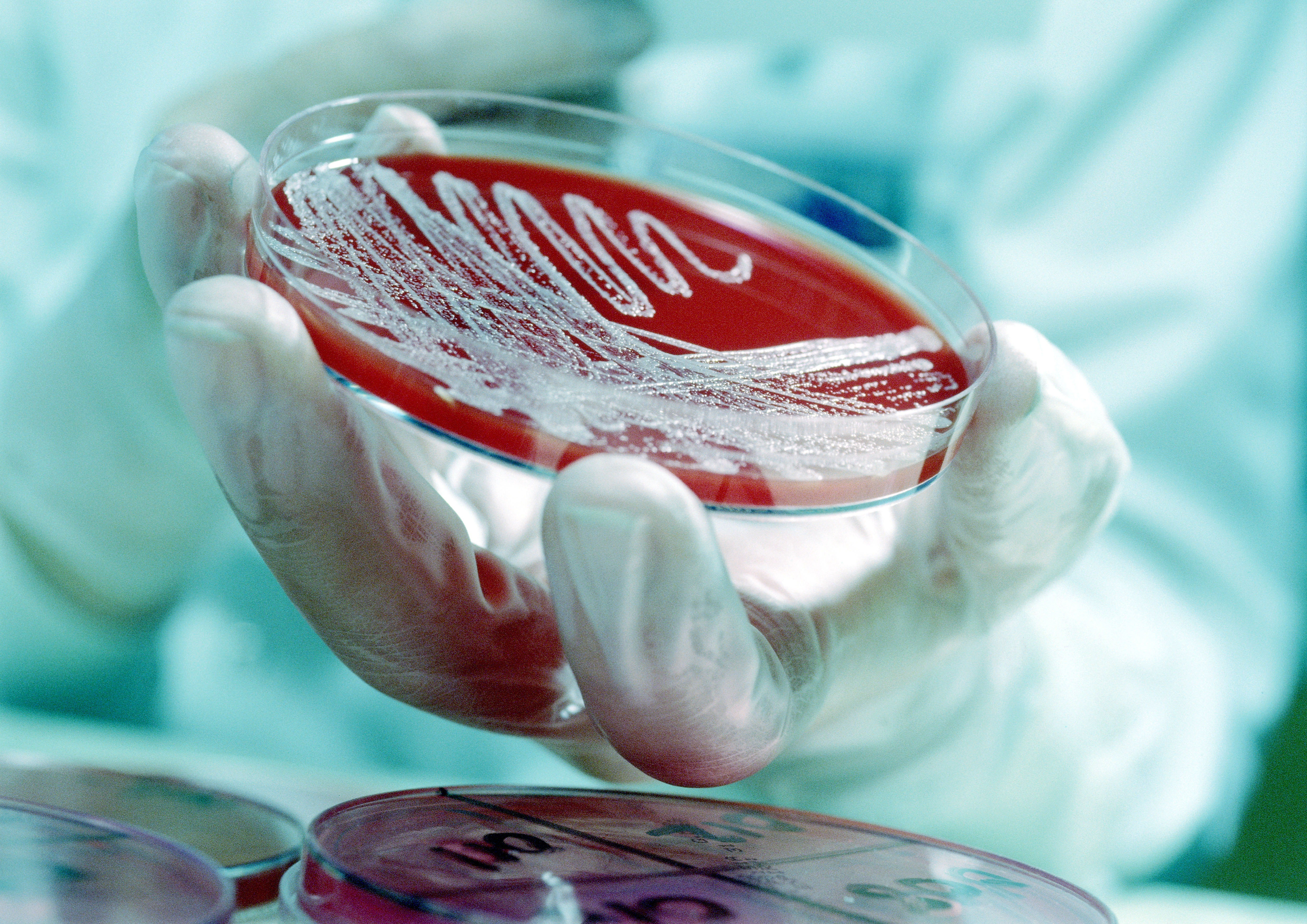 bacterial_growth_in_petri_dish.jpg