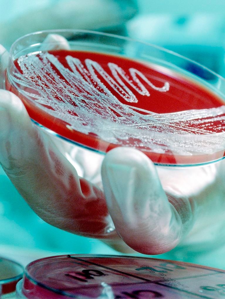 bacterial_growth_in_petri_dish.jpg