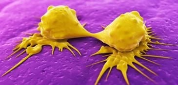 Cancer cells dividing_0.jpg