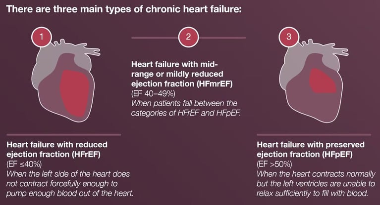 Medical illustration showing heart failure with reduced, mildly reduced and preserved ejection fraction (HFrEF, HFmrEF and HFpEF).