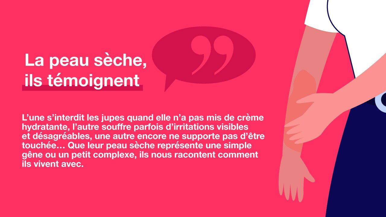 peau-seche-temoignage-1.jpg