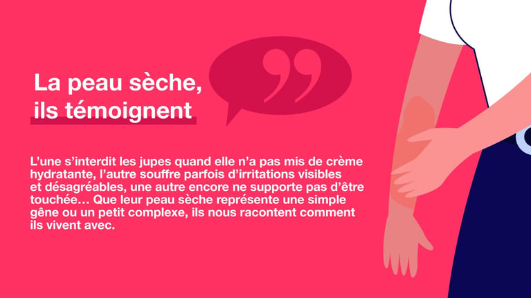 peau-seche-temoignage-1.jpg