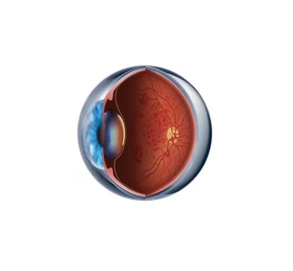 tromb-eye.jpg